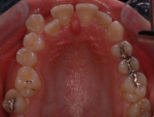 orthodontics 3 03