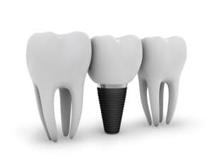 technology and expanded applications of dental implantology 5d554beb5dbd1