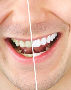 three ways to have a brighter smile and none of them are a whitening procedure 5d554c66d45f7